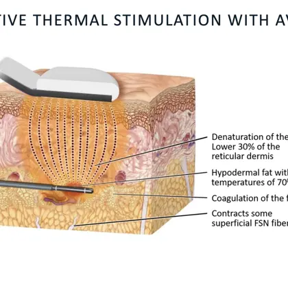 Screenshot 2023 05 22 At 14.05.47