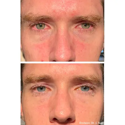 Envision Lumecca Before And After 01 2 (1)