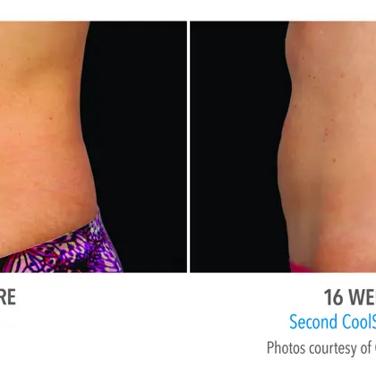 5Dc6fb3b 9995 4986 8D70 3462723De4e0 Source V