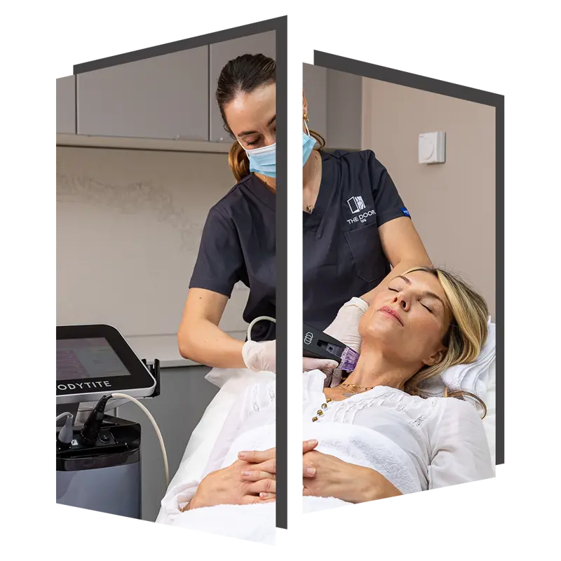 Morpheus8 skin tightening at The Door w4