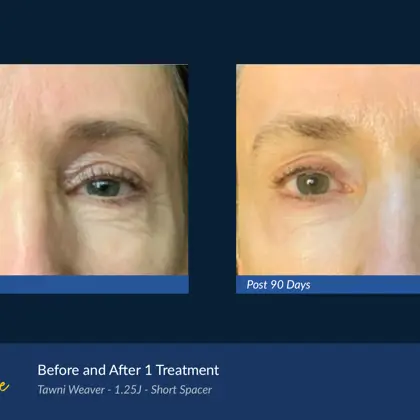 BA Agejet Eye Female Weaver 1