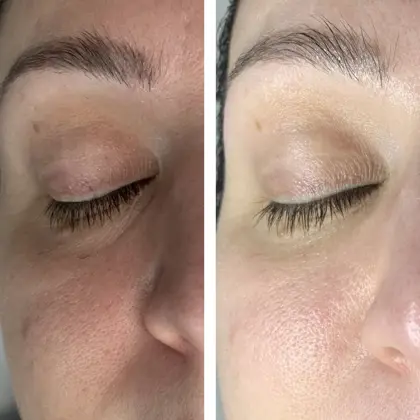 Beautifeye Cat Before And After4