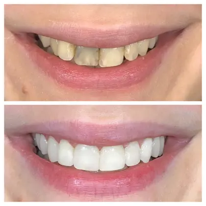 Facetune 23 12 2021 00 57 04