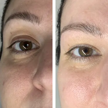 Beautifeye Cat Before And After1