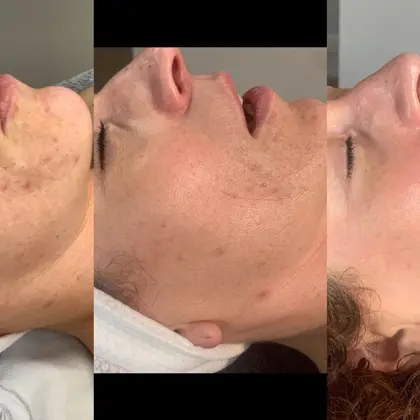 Lunchtime Peel X2 Dee