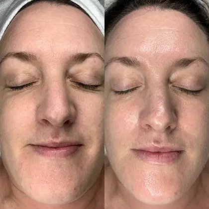 Bd179b0d 8088 443E Aa8b 752A2ac862b4