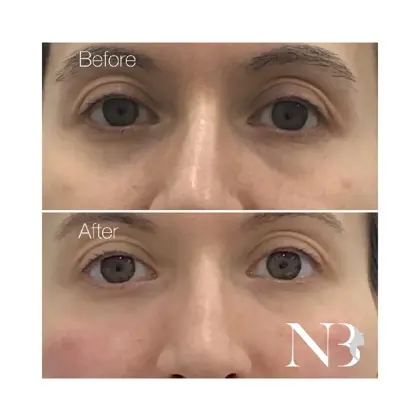 Before & Afters Dr Natasha 11