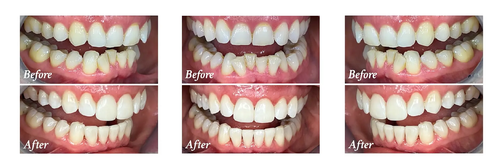 helen taylor before and after