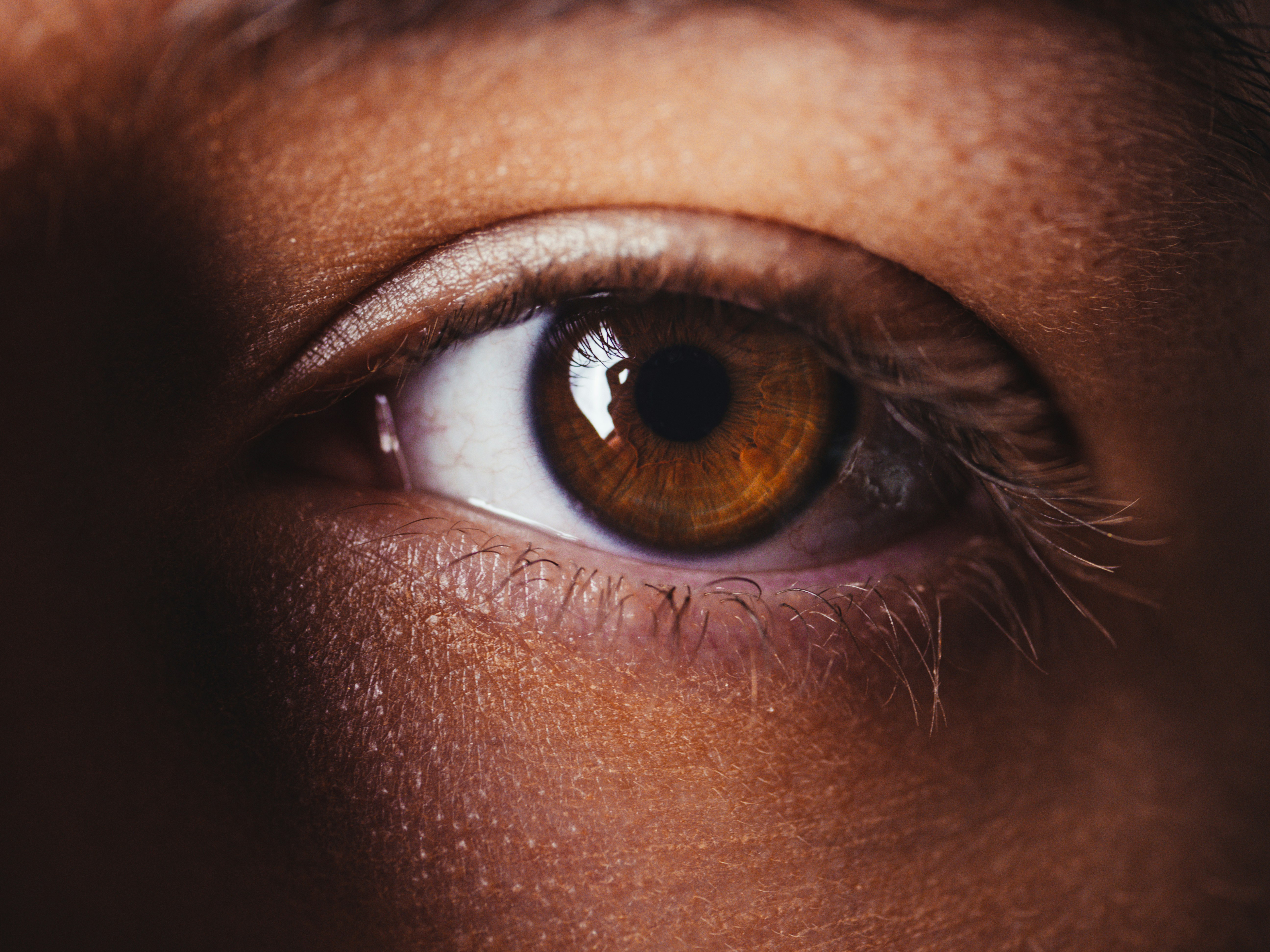 Forma-I (RF) Therapy