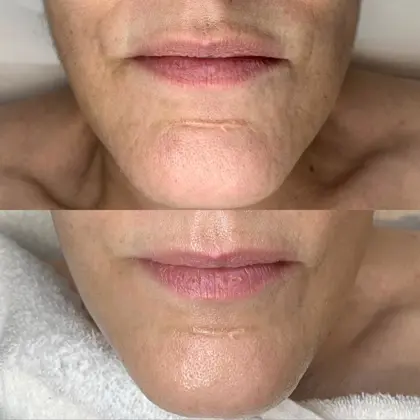 6Ba2868b 1C1e 4C26 8A4d 0B671fdc6c7b