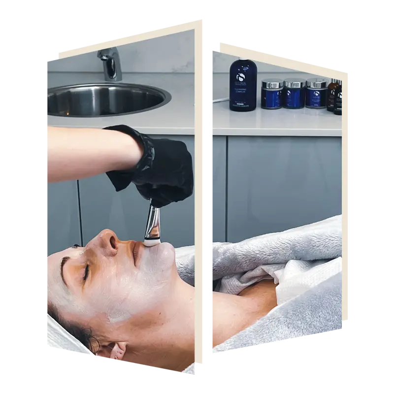 Fire and Ice facial at The Door W4