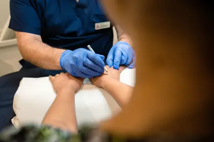 Hand Rejuvenation at The Door W4