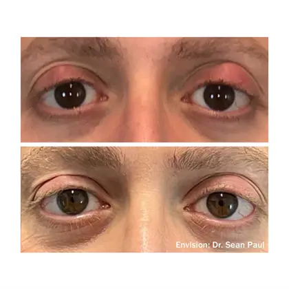 Envision Before And After 08 2 Copy (1)