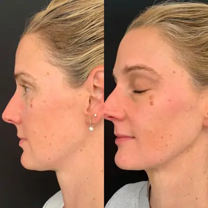 Agejet By Victoria 1