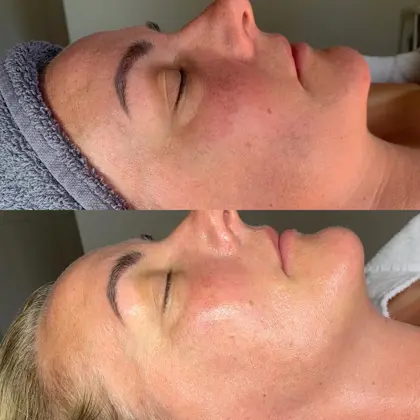 Bespoke Facial With Victoria 1