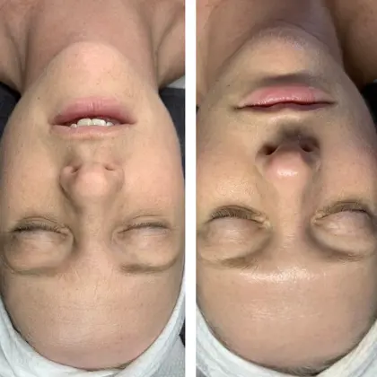 Fire And Ice Kate Before And After