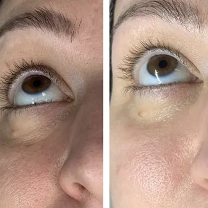 Beautifeye Cat Before And After3