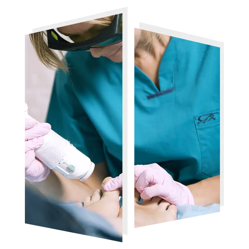 The Door w4 fungal nail treatment