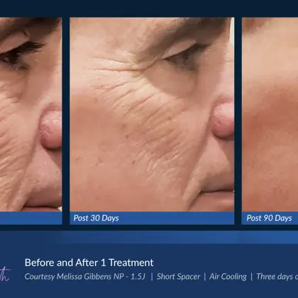 BA Agejet Smooth Femaie Gibbens