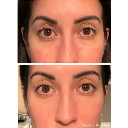 Envision Lumecca Before And After 06 2 (1)