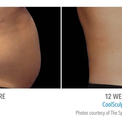 AB PLAS 145414145M(12W) RV 2Set