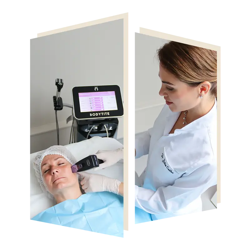 Morpheus8 non surgical skin tightening with DR Julia Coelho at The Door W4