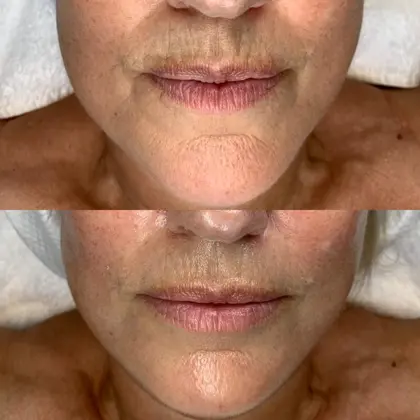 6E571ca5 5D51 48Ab B306 630B44f4b71b