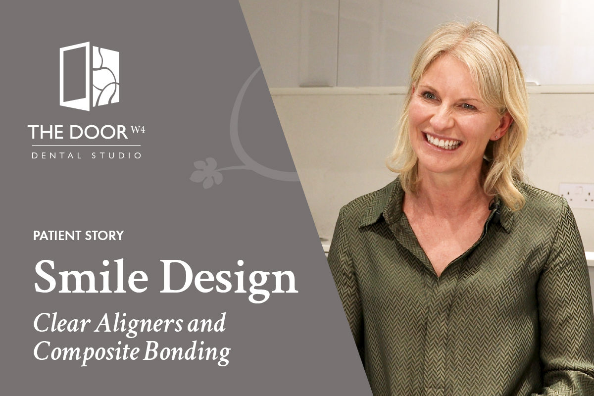 Helen's Smile Transformation: Clear Aligners and Composite Bonding with Dr. Julia Coelho at The Door W4 Dental Studio